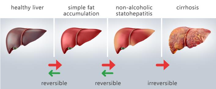 liver type