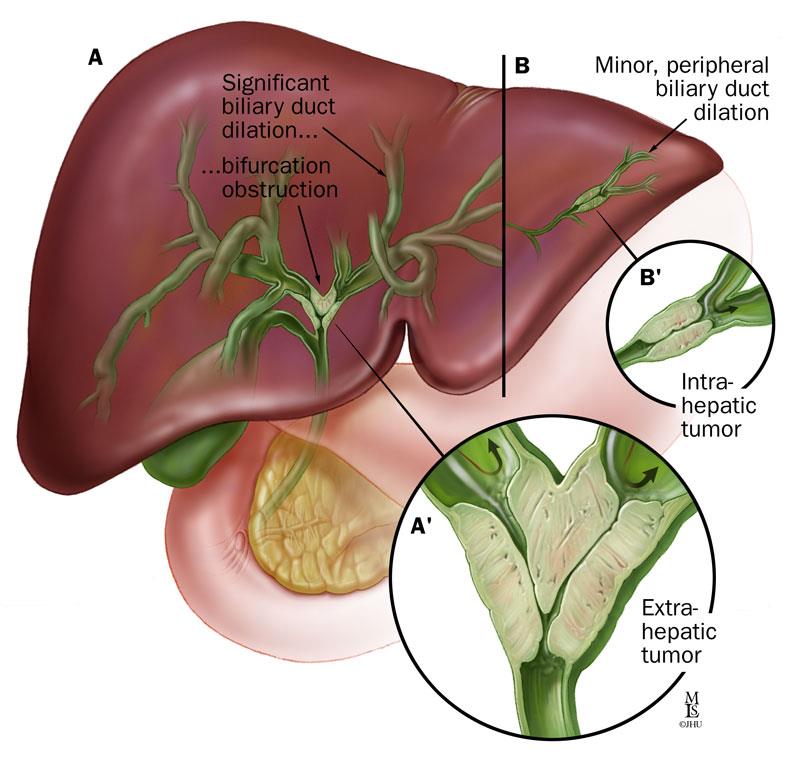 liver tree structure